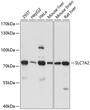 Anti-SLC7A2 Antibody (CAB14574)