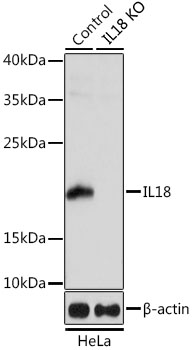 Anti-IL-18 Antibody [KO Validated] (CAB1115)