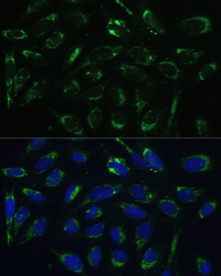 Anti-HSD17B10 Antibody (CAB5448)