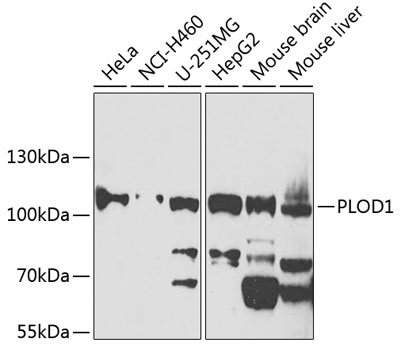 Anti-PLOD1 Antibody (CAB7919)