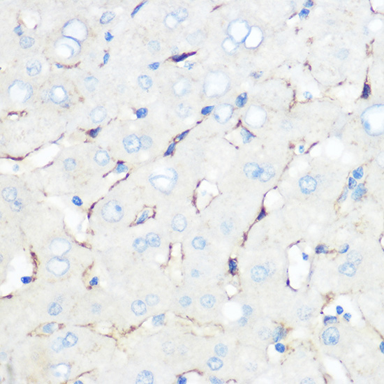 Anti-Caveolin-1 Antibody (CAB1555)