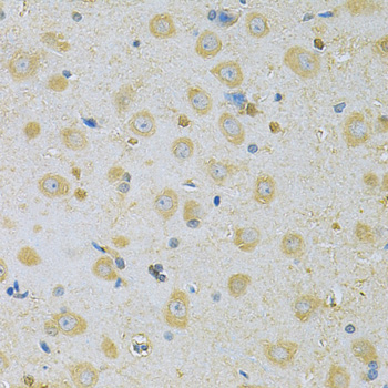 Anti-CAMK1G Antibody (CAB7379)