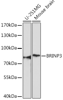 Anti-BRINP3 Antibody (CAB18237)
