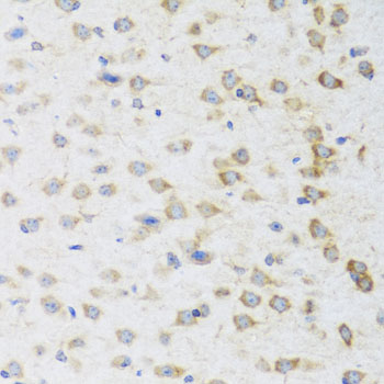 Anti-STRN Antibody (CAB7734)