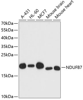 Anti-NDUFB7 Antibody (CAB13693)