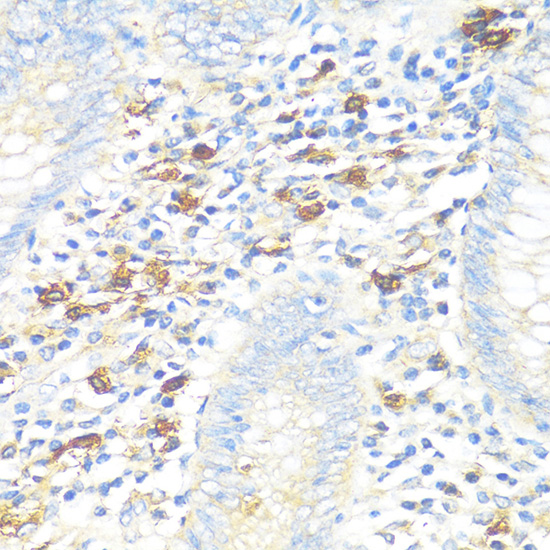 Anti-TPSAB1 Antibody (CAB14471)