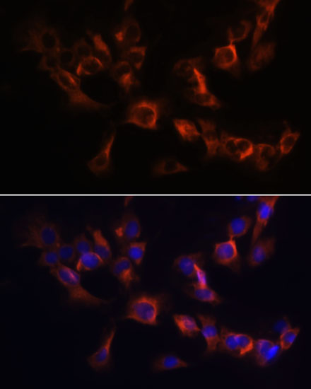 Anti-ARL13B Antibody (CAB5200)