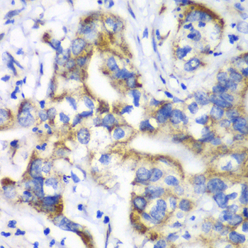 Anti-RPL9 Antibody (CAB6406)