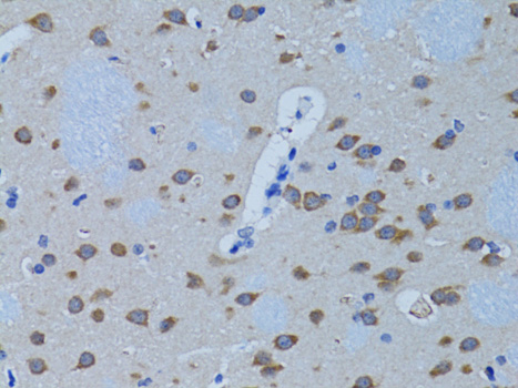 Anti-PLCB1 Antibody (CAB1971)