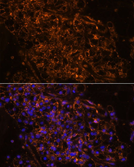 Anti-SCNN1G Antibody (CAB15097)