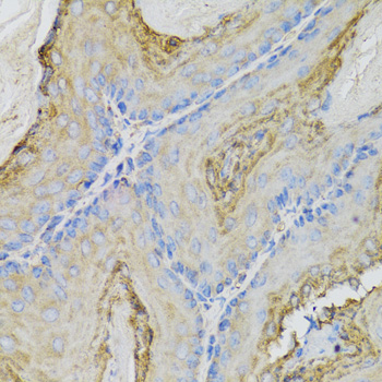 Anti-CALML5 Antibody (CAB7808)