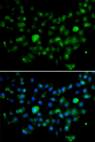 Anti-MCM10 Antibody (CAB5427)