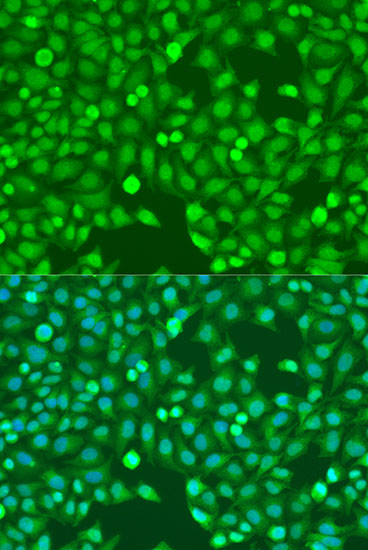 Anti-MEF2A Antibody (CAB7911)