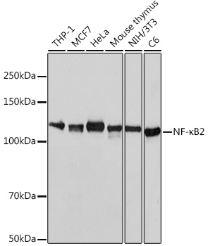 NF-kB2 Rabbit Monoclonal Antibody (CAB19605)