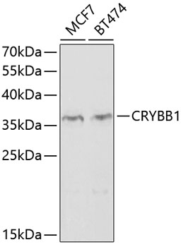 Anti-CRYBB1 Antibody (CAB2590)