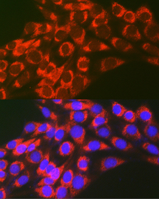 Anti-TFEB Antibody (CAB7311)