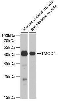 Anti-TMOD4 Antibody (CAB6772)