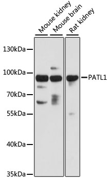 Anti-PATL1 Antibody (CAB13170)