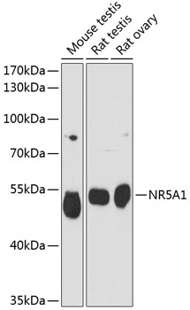 Anti-NR5A1 Antibody (CAB1657)