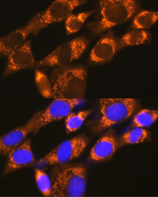 Anti-EIF4G2 Antibody (CAB2897)