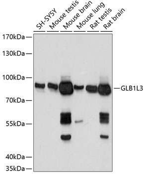 Anti-GLB1L3 Antibody (CAB14953)