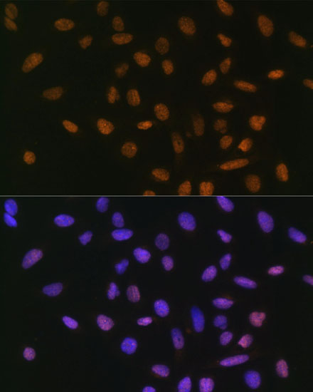 Anti-Snail Antibody (CAB5243)