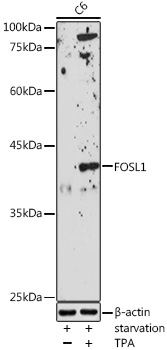 Anti-FOSL1 Antibody (CAB5372)