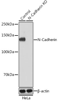 Anti-N-Cadherin Antibody [KO Validated] (CAB19083)