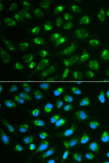 Anti-IL-7 Antibody (CAB1650)