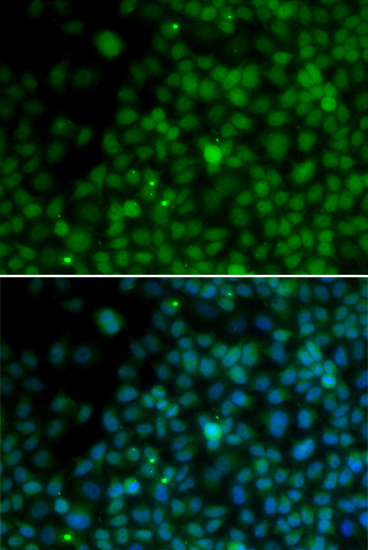 Anti-IRF4 Antibody (CAB1052)