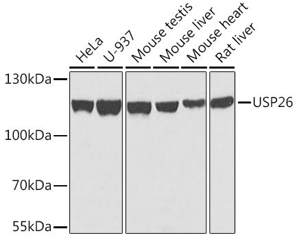 Anti-USP26 Polyclonal Antibody (CAB7999)