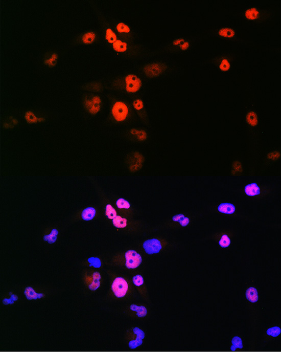 Anti-MYOD1 Antibody (CAB16218)