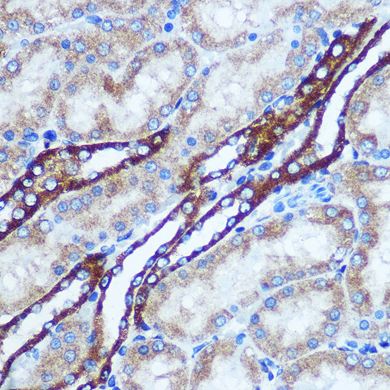 Anti-GSTT1 Antibody (CAB1287)