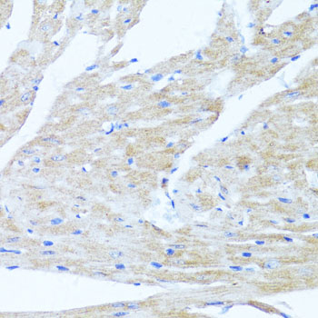 Anti-ULk1 Polyclonal Antibody (CAB8529)