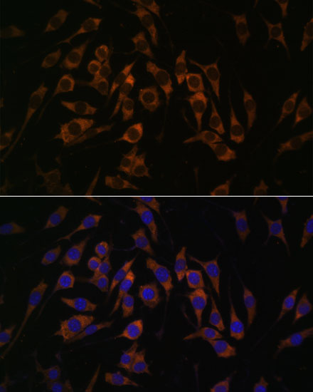 Anti-RPS13 Antibody (CAB15720)