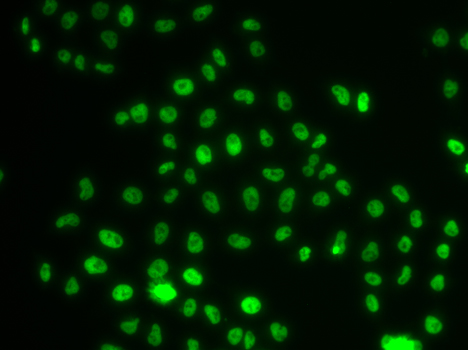 Anti-PHIP Antibody (CAB7207)