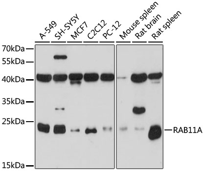 Anti-RAB11A Antibody (CAB17031)