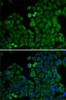 Anti-E2F6 Antibody (CAB6151)