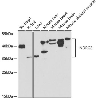 Anti-NDRG2 Antibody (CAB5319)