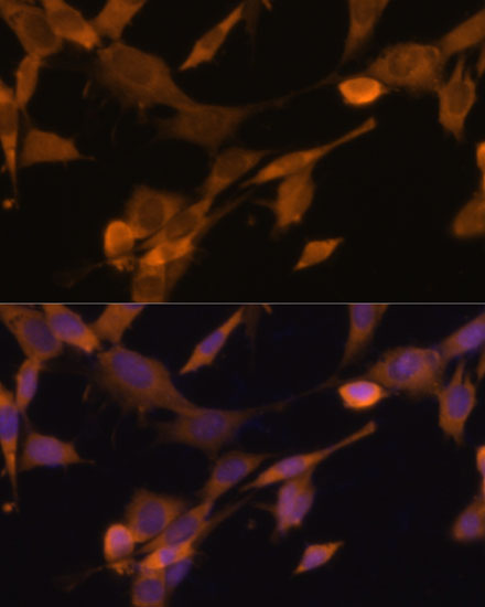 Anti-Ubiquilin-2 Polyclonal Antibody (CAB9568)