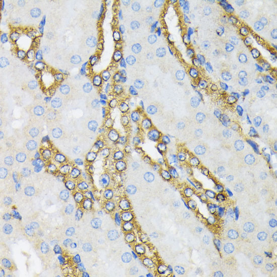 Anti-HSP90B1 Antibody (CAB0989)