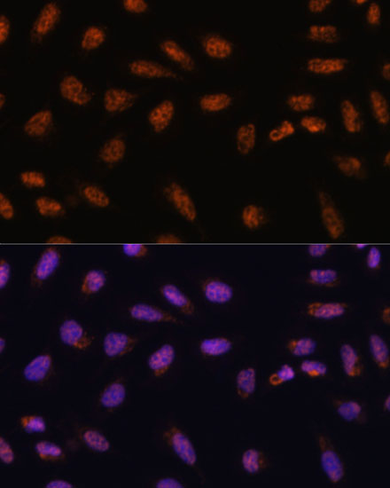 Anti-SARNP Antibody (CAB13701)