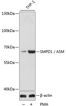 Anti-SMPD1 / ASM Antibody (CAB16263)