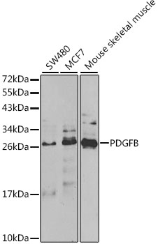 Anti-PDGFB Antibody (CAB1195)