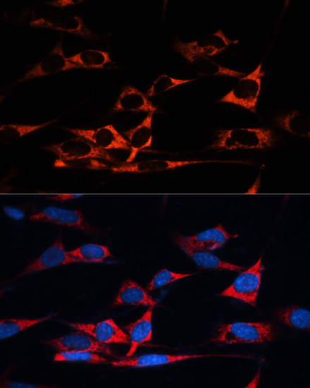 Anti-MAP1B Antibody (CAB3305)