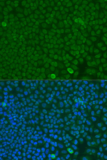 Anti-FBXW7 Antibody (CAB5872)