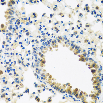 Anti-IFNL3 Antibody (CAB12908)