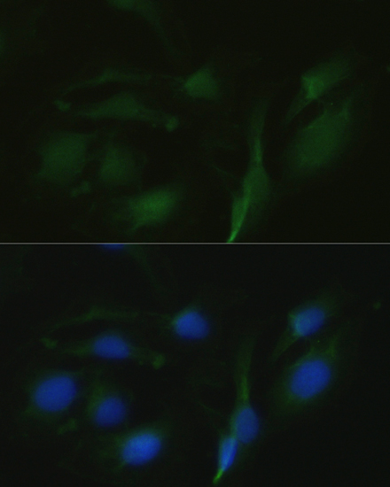 Anti-TRPV1 Polyclonal Antibody (CAB8564)