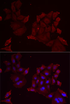 Anti-PANX1 Antibody (CAB13587)