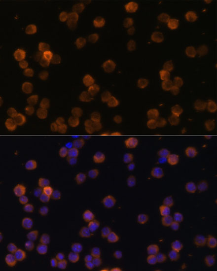 Anti-CD86 Antibody (CAB1199)